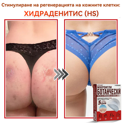 🗽✅ GFOUK® Ботаничен пластир с микроигли за премахване на кожни образувания 🇺🇸 Произведено в САЩ