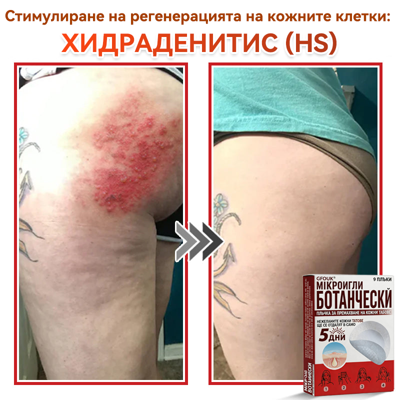 🗽✅ GFOUK® Ботаничен пластир с микроигли за премахване на кожни образувания 🇺🇸 Произведено в САЩ