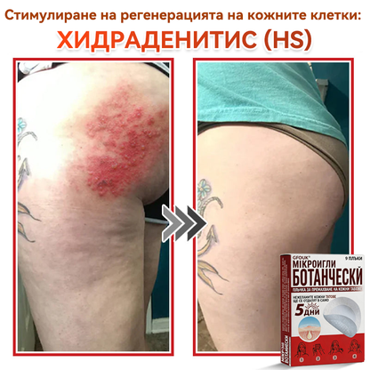 🗽✅ GFOUK® Ботаничен пластир с микроигли за премахване на кожни образувания 🇺🇸 Произведено в САЩ