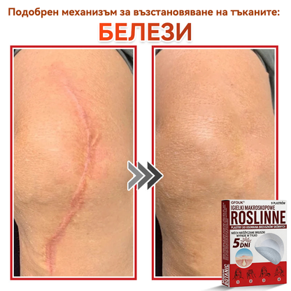 🗽✅ GFOUK® Ботаничен пластир с микроигли за премахване на кожни образувания 🇺🇸 Произведено в САЩ