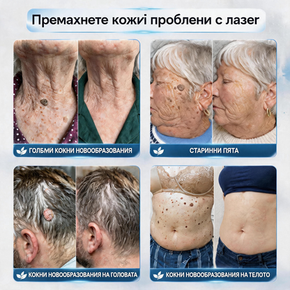 🌱 Официален магазин на водещата марка | 👩‍⚕️𝐏𝐢𝒄𝒅𝒐® 7-дневен серум за премахване на тъмни петна и кожни образувания (безболезнен дизайн с ролковидни топчета; не оставя белези) 🌳