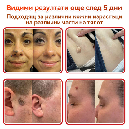 🗽✅ GFOUK® Ботаничен пластир с микроигли за премахване на кожни образувания 🇺🇸 Произведено в САЩ