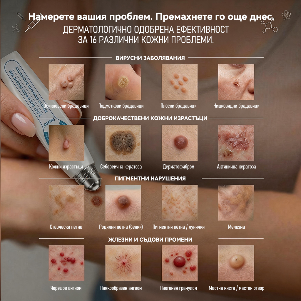🌱 Официален магазин на водещата марка | 👩‍⚕️𝐏𝐢𝒄𝒅𝒐® 7-дневен серум за премахване на тъмни петна и кожни образувания (безболезнен дизайн с ролковидни топчета; не оставя белези) 🌳