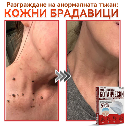 🗽✅ GFOUK® Ботаничен пластир с микроигли за премахване на кожни образувания 🇺🇸 Произведено в САЩ