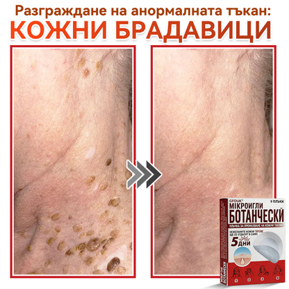 🗽✅ GFOUK® Ботаничен пластир с микроигли за премахване на кожни образувания 🇺🇸 Произведено в САЩ