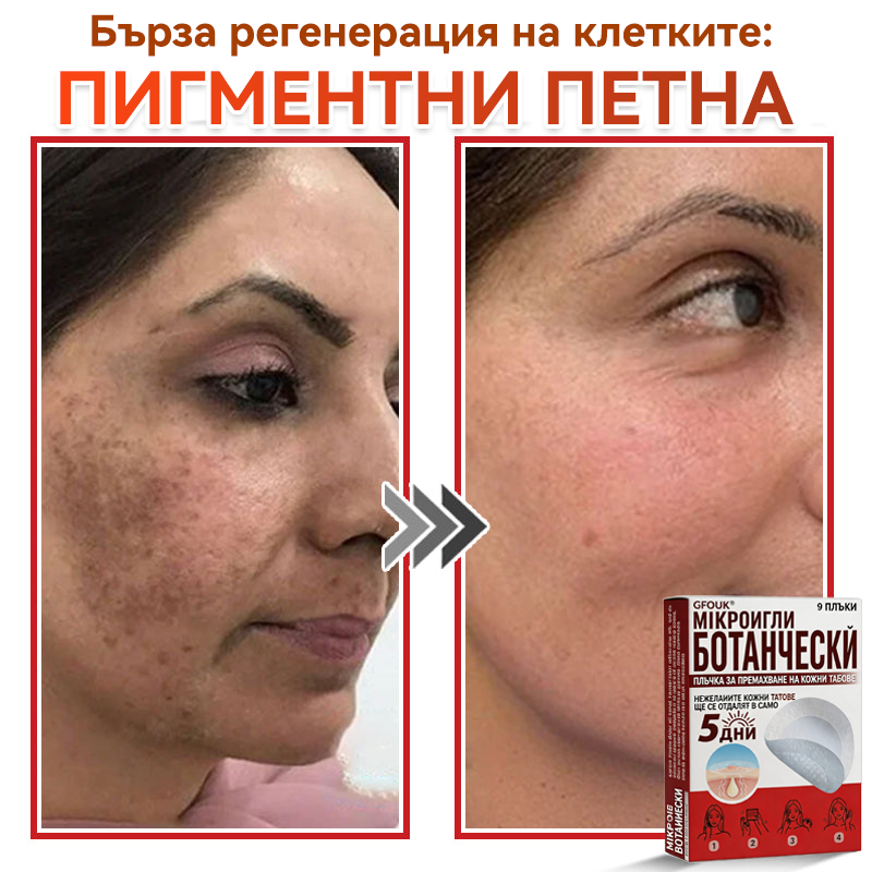 🗽✅ GFOUK® Ботаничен пластир с микроигли за премахване на кожни образувания 🇺🇸 Произведено в САЩ