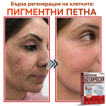 🗽✅ GFOUK® Ботаничен пластир с микроигли за премахване на кожни образувания 🇺🇸 Произведено в САЩ
