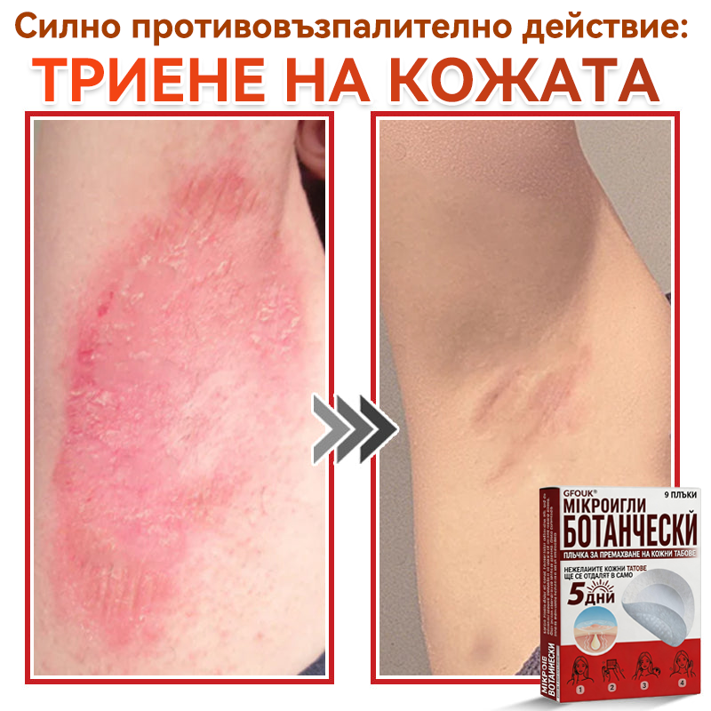 🗽✅ GFOUK® Ботаничен пластир с микроигли за премахване на кожни образувания 🇺🇸 Произведено в САЩ