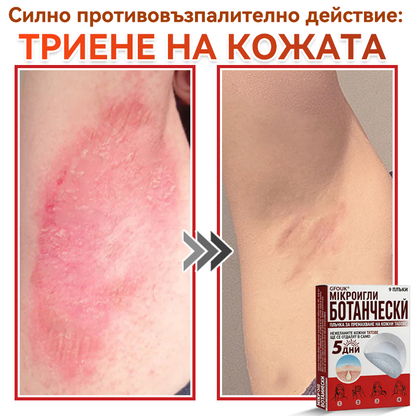 🗽✅ GFOUK® Ботаничен пластир с микроигли за премахване на кожни образувания 🇺🇸 Произведено в САЩ
